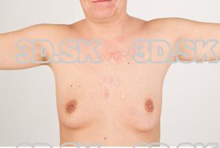 Breast texture of Pat 0001